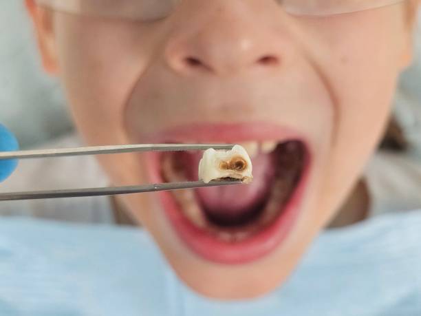 Best Dentist Open Late Near Me  in Smithville, MO